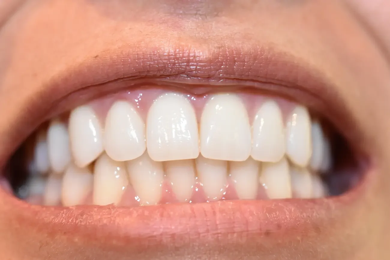 Jak rozpoznać naprawdę polecanego dentystę? 7 cech dobrego specjalisty